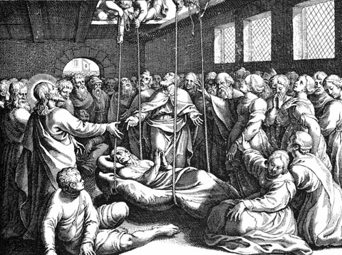 5 Ways to “Remove the&nbsp;Roof”